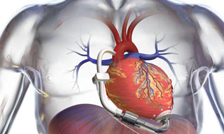 Cardiochirurgia
